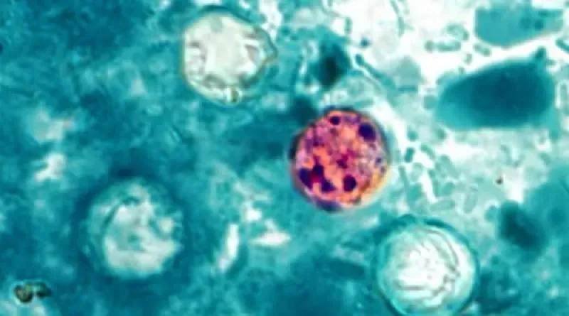 Hoa Kỳ chưa thể kiểm soát hoàn toàn đợt bùng phát dịch cyclosporiasis?