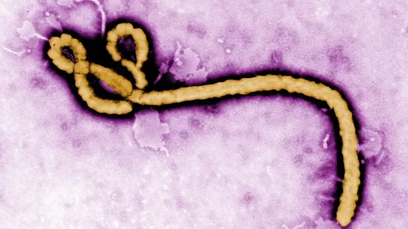 CDC: Một công dân Hoa Kỳ tại Congo dương tính virus Ebola