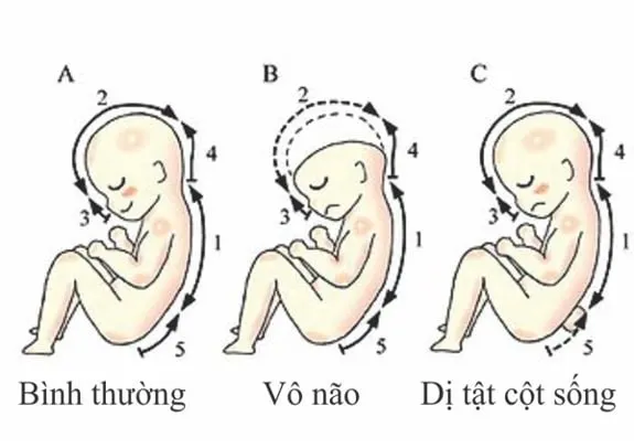 Đậu bắp – Thực phẩm vàng cho sức khỏe
