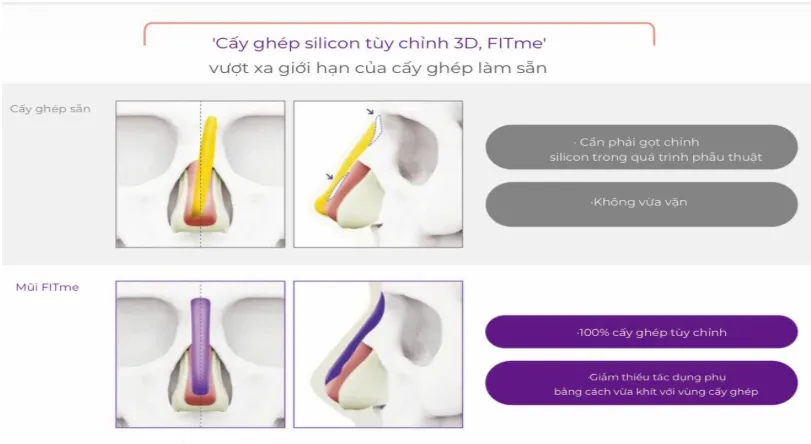cong-nghe-3d-fitme-lan-song-moi-trong-phau-thuat-tham-my-hien-nay-1_11zon.webp công nghệ cấy ghép silicon tùy chỉnh mang tên “FITme 3D”