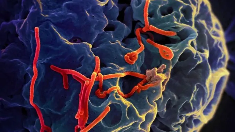 Việt Nam ứng ph&oacute; khẩn cấp sau cảnh b&aacute;o từ WHO về dịch Ebola