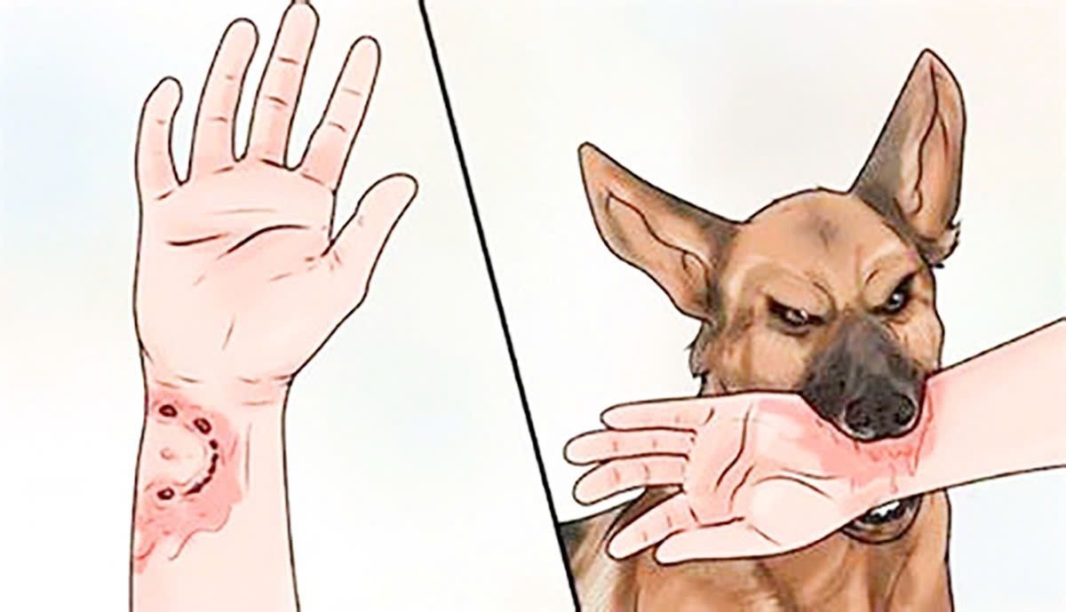 Bệnh dại: Những điều bạn cần biết để phòng tránh Bệnh dại: Những điều bạn cần biết để phòng tránh