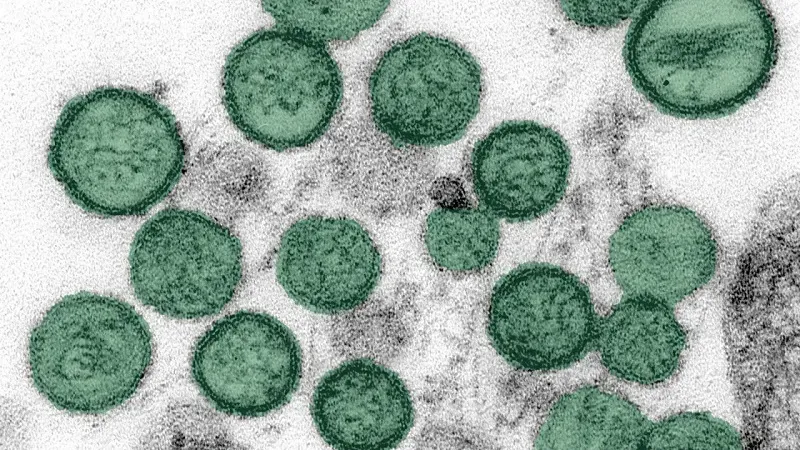 Hoa Kỳ lên kế hoạch sơ tán công dân khỏi du thuyền bùng phát hantavirus