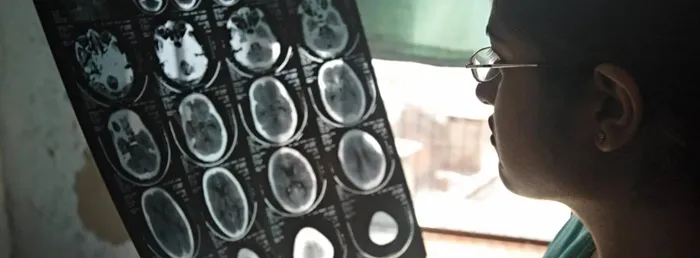 WHO-benh-ly-than-kinh-gay-hon-11-trieu-ca-tu-vong-moi-nam-1_11zon.webp WHO: Bệnh lý thần kinh gây hơn 11 triệu ca tử vong mỗi năm