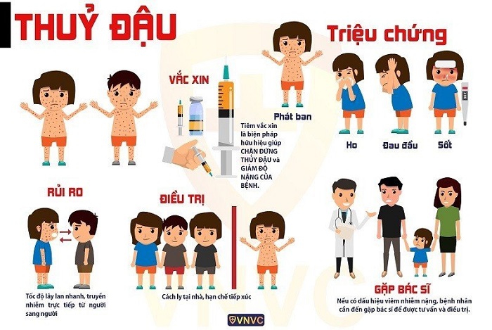 Số ca mắc thủy đậu tăng cao - Bộ Y tế nêu biện pháp Số ca mắc thủy đậu tăng cao - Bộ Y tế nêu biện pháp
